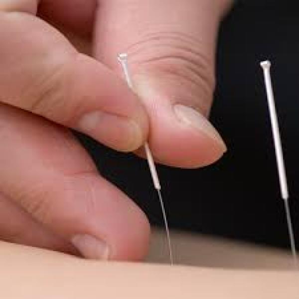 TUNG ACUPUNCTURE